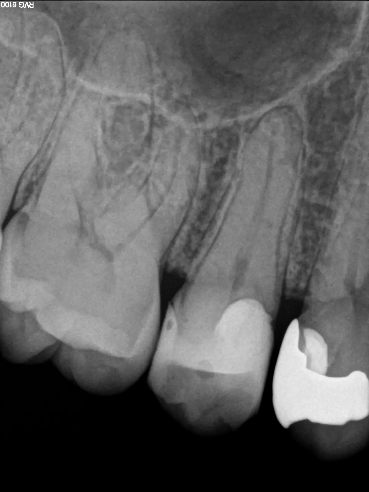 15situ (2)